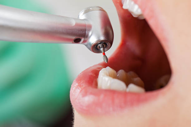 Best Emergency Tooth Extraction  in Chicago, IL